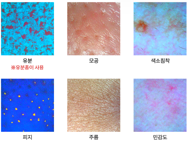 피부 진단기